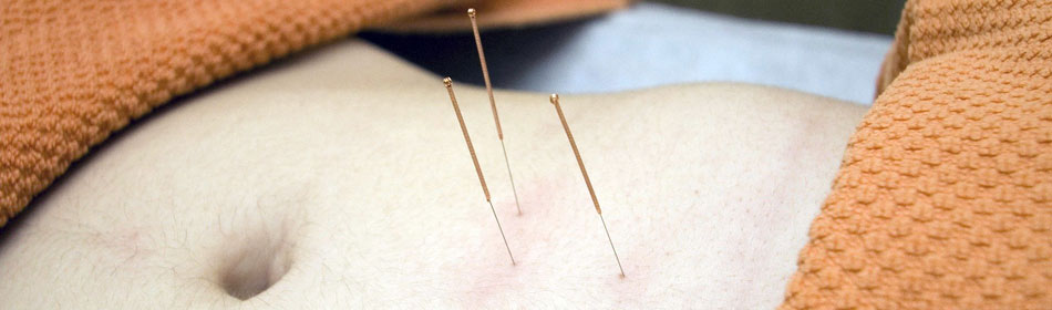 Accupuncture, Eastern Healing Arts in the Morrisville, Bucks County PA area